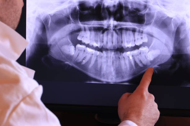 Best Tooth Infection Emergency Dentist  in Rio, WI